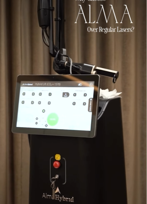Alma Laser Machine